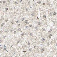 HPA IHC Liver — MAP3K4