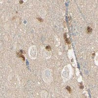 HPA IHC Cerebral cortex — MAP3K4