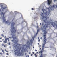 HPA IHC Colon — RDX