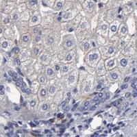 HPA IHC Liver — RDX