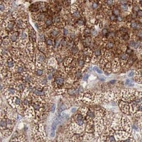 HPA IHC Adrenal gland — RDX