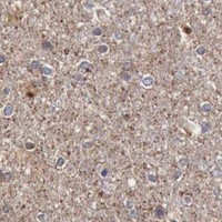 HPA IHC Cerebral cortex — RDX
