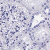 HPA IHC Kidney — KLK3