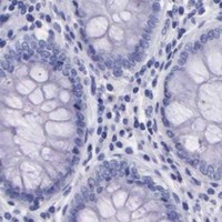 HPA IHC Colon — KLK3