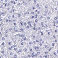 HPA IHC Liver — KLK3