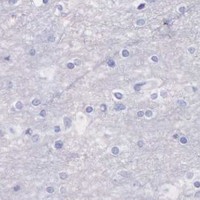 HPA IHC Cerebral cortex — KLK3
