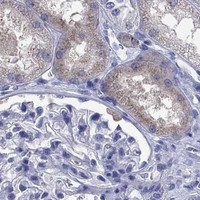 HPA IHC Kidney — SERPINB2