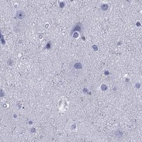 HPA IHC Cerebral cortex — SERPINB2