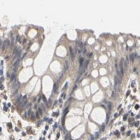 HPA IHC Colon — TAOK1