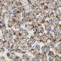 HPA IHC Liver — TAOK1