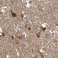 HPA IHC Cerebral cortex — TAOK1