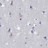 HPA IHC Cerebral cortex — GZMA