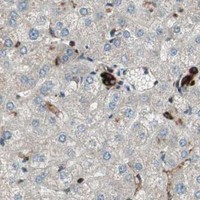 HPA IHC Liver — PRKG1