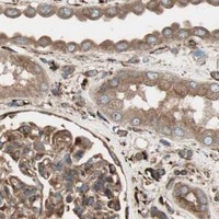 HPA IHC Kidney — PRKG1