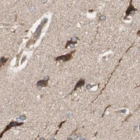 HPA IHC Cerebral cortex — PRKG1