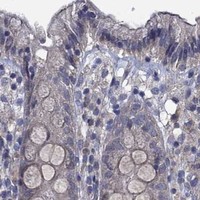 HPA IHC Colon — HAP1