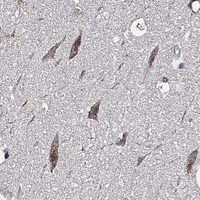 HPA IHC Hippocampus — HAP1