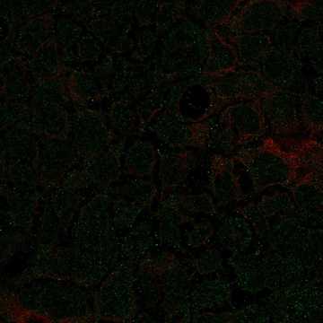 HPA077030: CACO-2