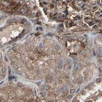 HPA IHC Kidney — AGBL2