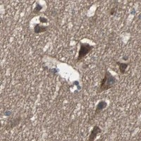 HPA IHC Cerebral cortex — ARF1