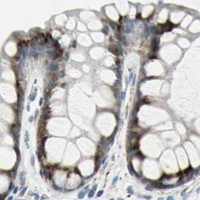 HPA IHC Colon — BBC3