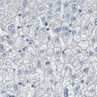 HPA IHC Liver — BBC3