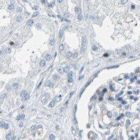 HPA IHC Kidney — BBC3
