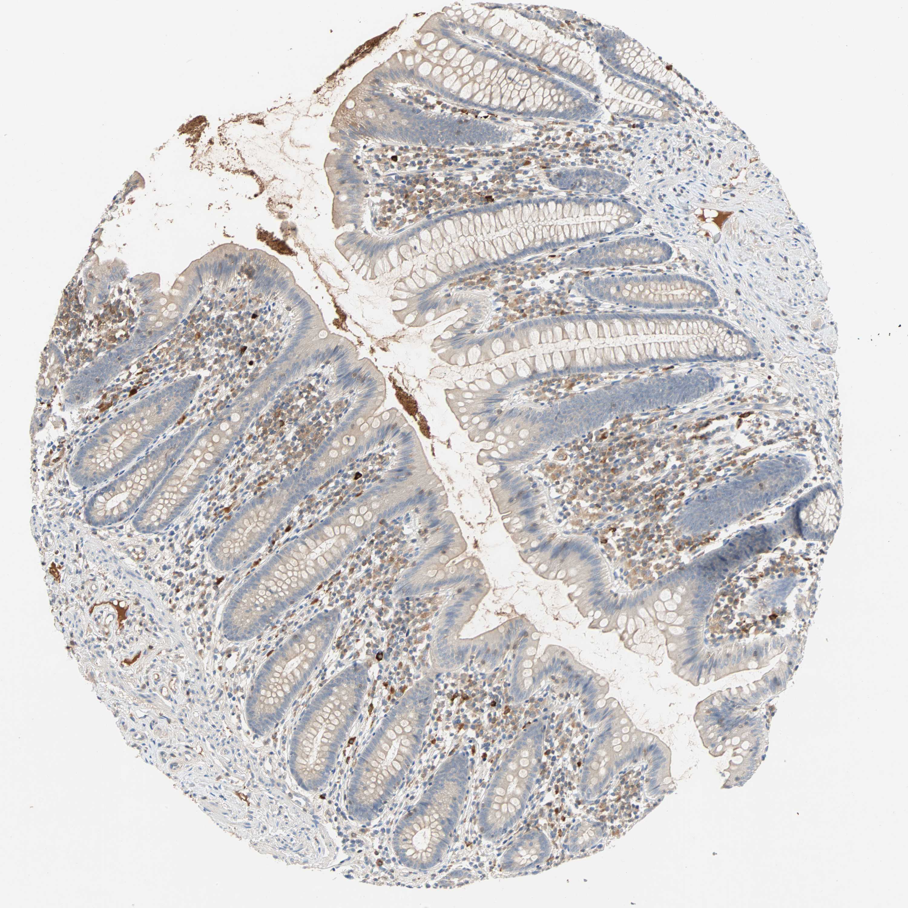 Tissue expression of MAP4K1 Staining in appendix The Human Protein