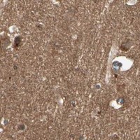 HPA IHC Cerebral cortex — FLOT1