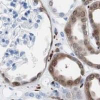HPA IHC Kidney — SYK