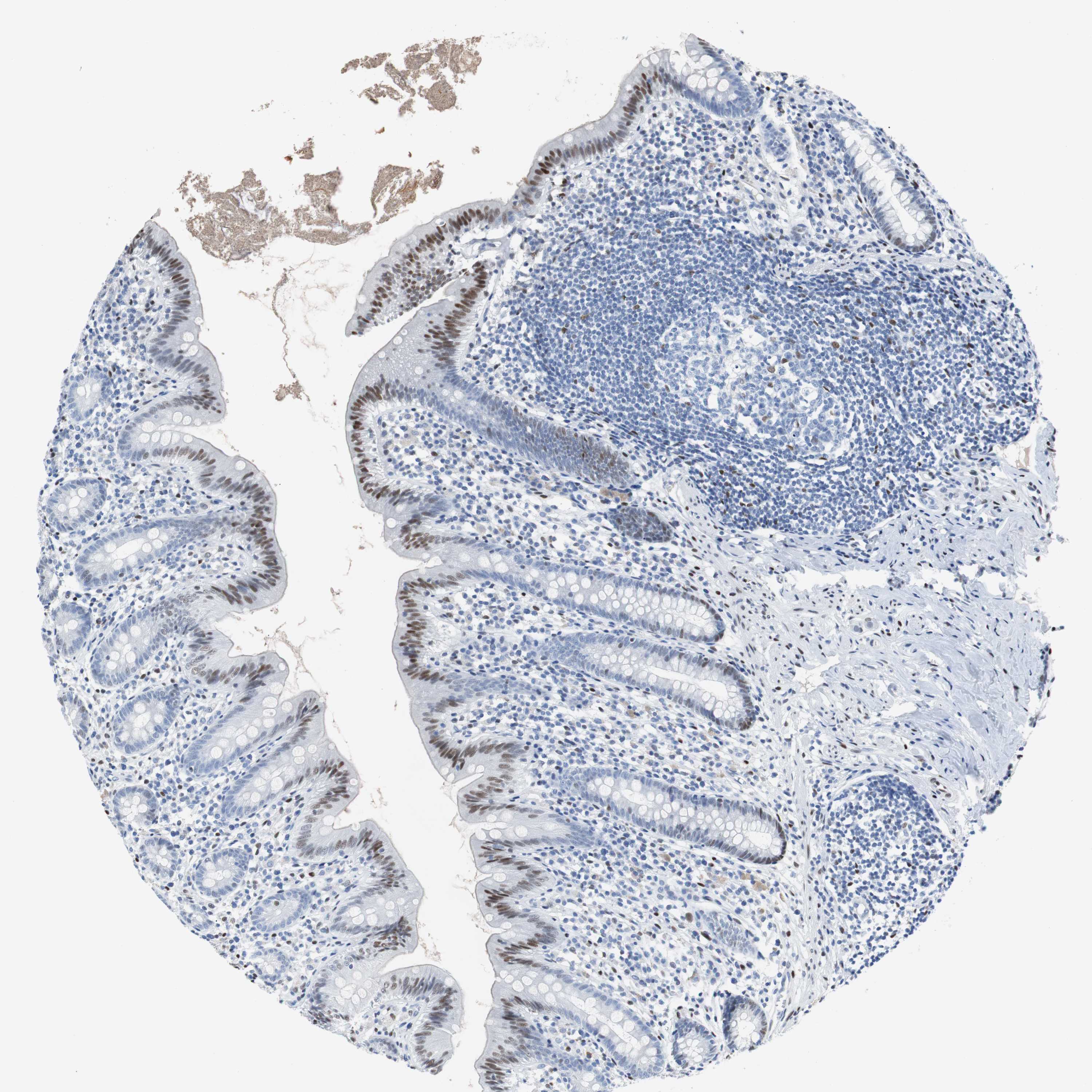 Tissue expression of JUN Staining in appendix The Human Protein Atlas