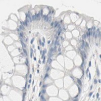 HPA IHC Colon — NEFH