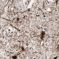HPA IHC Cerebral cortex — NEFH