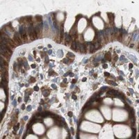 HPA IHC Colon — GYS1