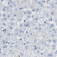 HPA IHC Liver — GYS1