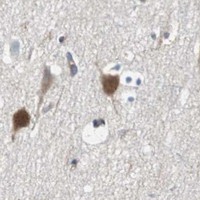 HPA IHC Cerebral cortex — GYS1