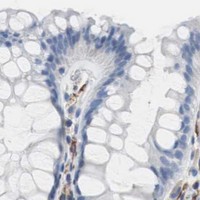 HPA IHC Colon — FCGR2B