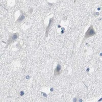 HPA IHC Cerebral cortex — FCGR2B