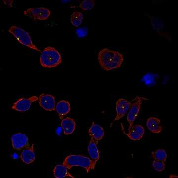 HPA077996: REH