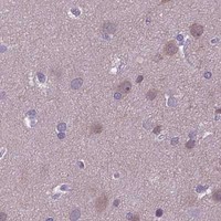HPA IHC Cerebral cortex — PPP1R1A