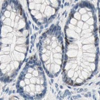 HPA IHC Colon — CCNE2