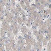 HPA IHC Liver — CASQ1