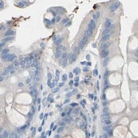 HPA IHC Colon — CASQ1