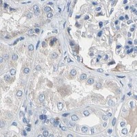 HPA IHC Kidney — CASQ1