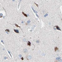 HPA IHC Cerebral cortex — CASQ1
