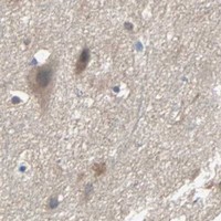 HPA IHC Cerebral cortex — TNFRSF12A