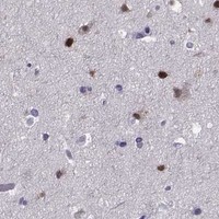 HPA IHC Cerebral cortex — TBR1