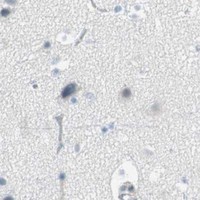 HPA IHC Cerebral cortex — AGR2