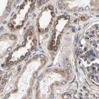 HPA IHC Kidney — SLC39A9