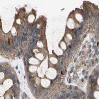 HPA IHC Colon — SLC39A9